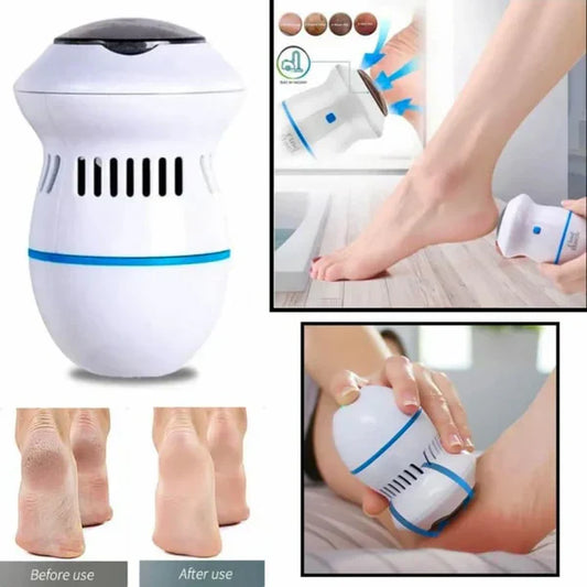 SilkGlide™ – Elektrisk fotfil för silkeslena fötter
