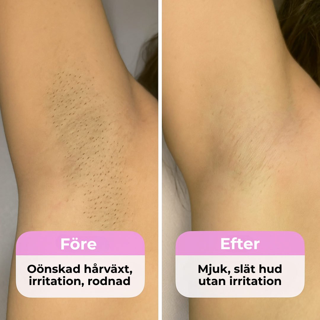 RakTrim™ - Perfekt trim. Slät rakning. Allt i ett.